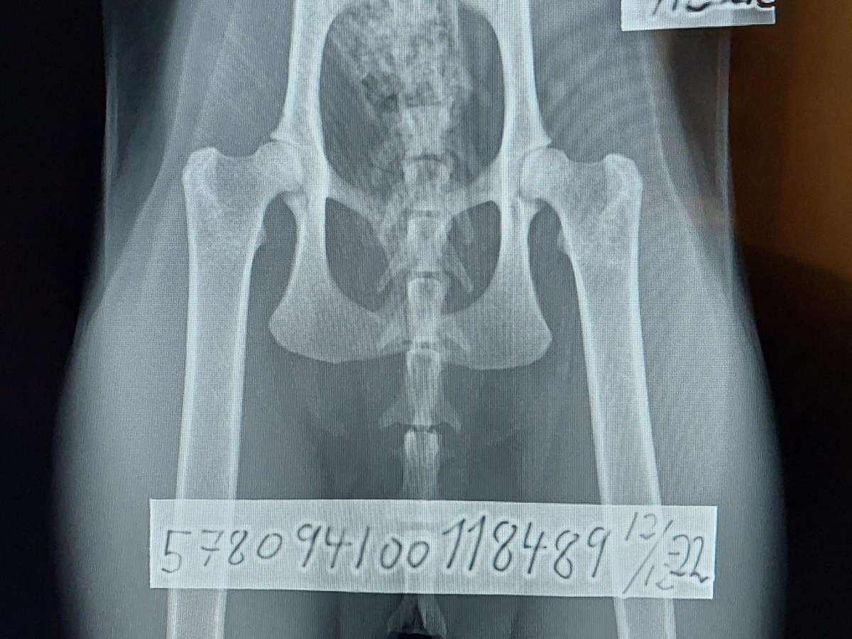 HD x-ray Nylah